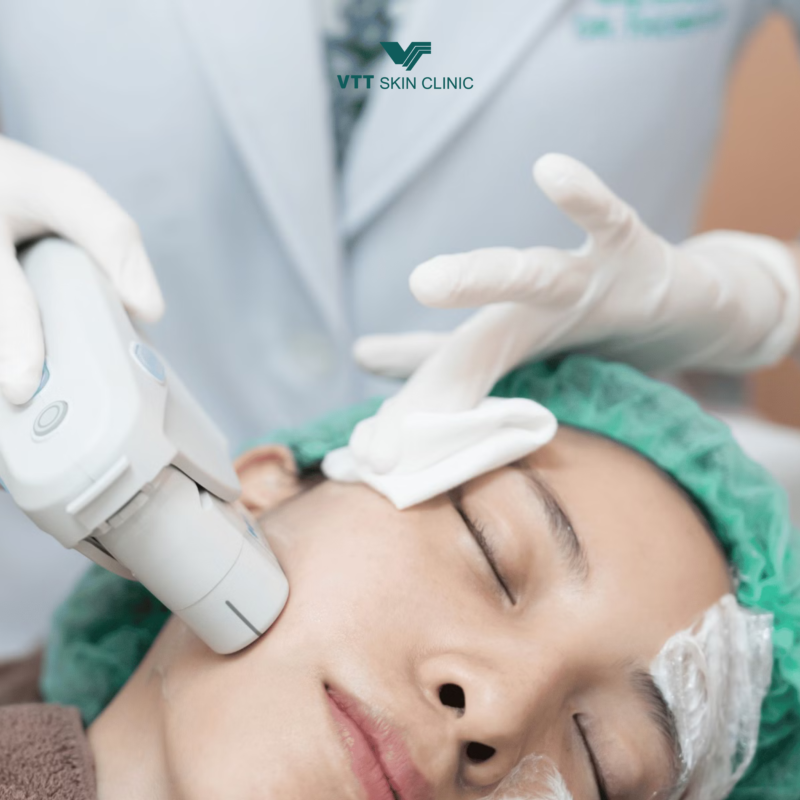 Tổng quan về Ultherapy và Thermage