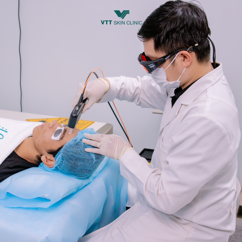 Cơ chế hoạt động của laser dual yellow