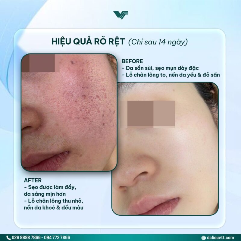 Hiệu quả lâm sàng thực tế sau khi điều trị