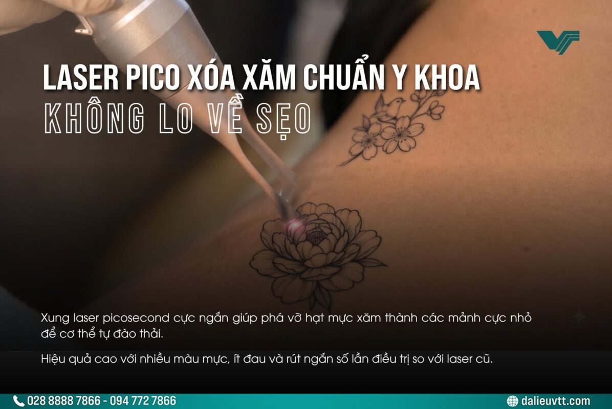 Công nghệ xoá xăm Laser Pico